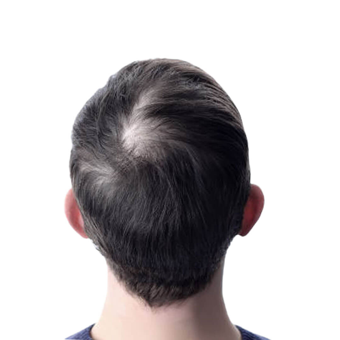 Toppik hair fiber original